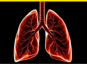 Раннее обнаружение рака легких